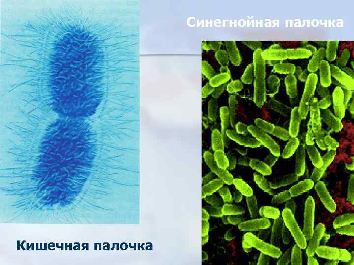 Синегнойная палочка Кишечная палочка 