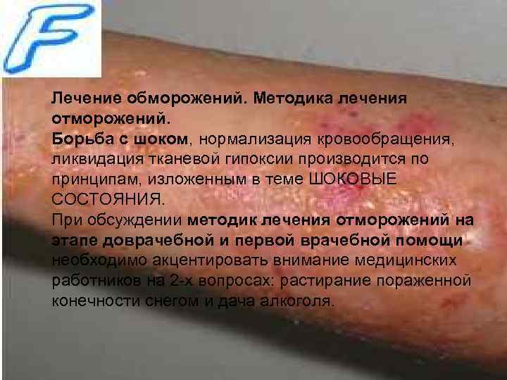 Лечение обморожений. Методика лечения отморожений. Борьба с шоком, нормализация кровообращения, ликвидация тканевой гипоксии производится