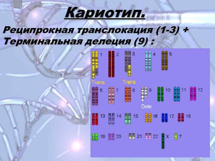 Кариотип. Реципрокная транслокация (1 -3) + Терминальная делеция (9) : 