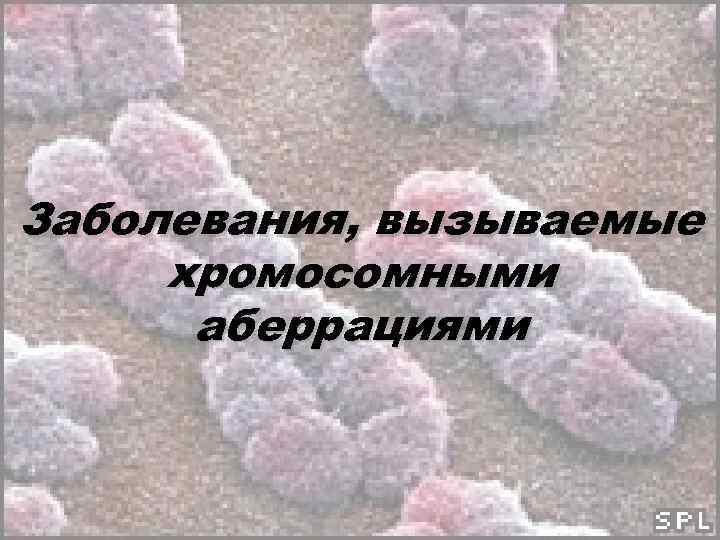 Заболевания, вызываемые хромосомными аберрациями 