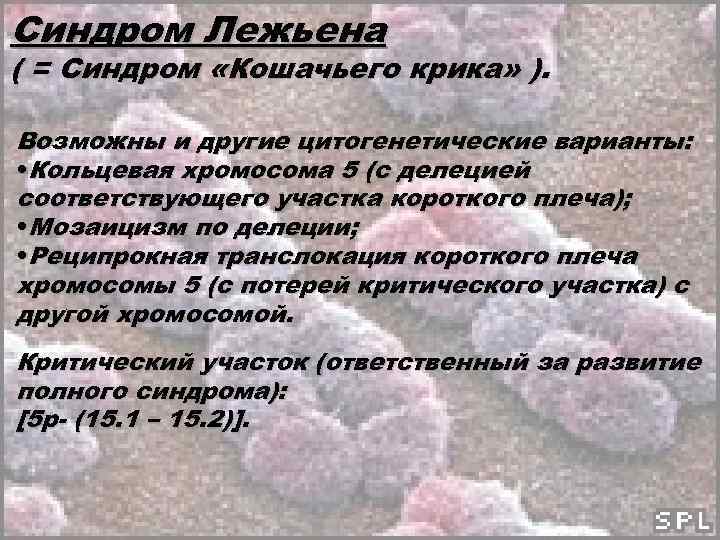 Синдром Лежьена ( = Синдром «Кошачьего крика» ). Возможны и другие цитогенетические варианты: •