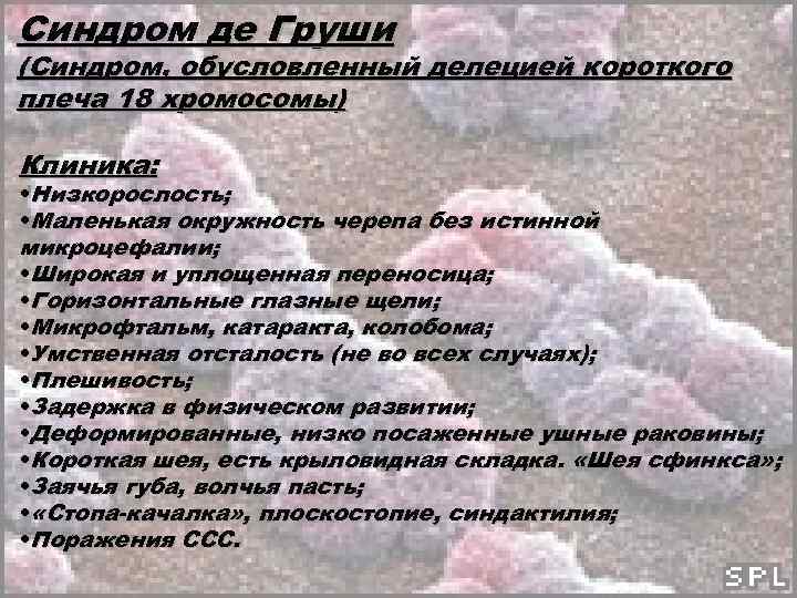 Синдром де груши презентация