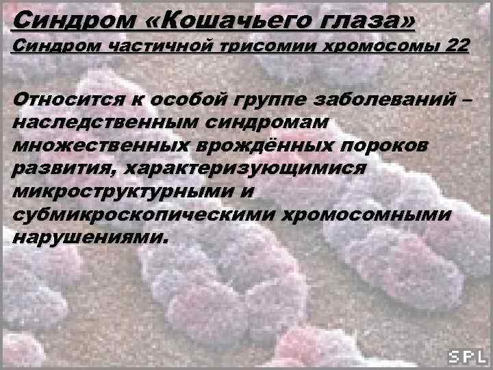 Синдром «Кошачьего глаза» Синдром частичной трисомии хромосомы 22 Относится к особой группе заболеваний –