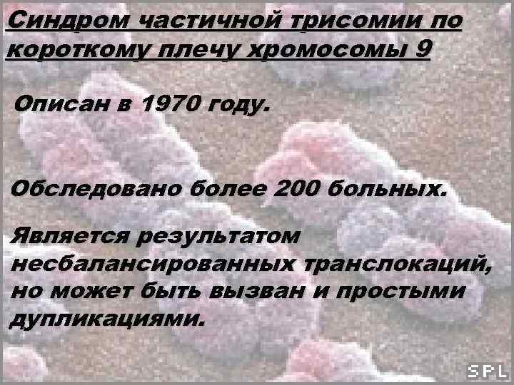 Синдром частичной трисомии по короткому плечу хромосомы 9 Описан в 1970 году. Обследовано более