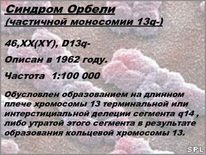 Синдром орбели презентация