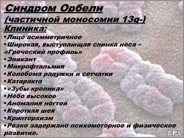 Синдром орбели презентация