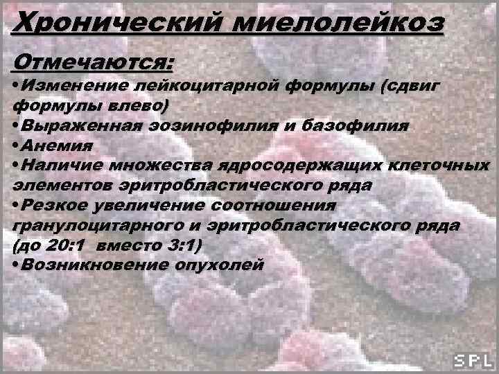 Хронический миелолейкоз Отмечаются: • Изменение лейкоцитарной формулы (сдвиг формулы влево) • Выраженная эозинофилия и