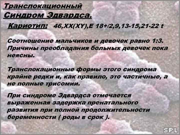 Транслокационный Синдром Эдвардса. Кариотип: 46, ХХ(ХY), E 18+/2, 9, 13 -15, 21 -22 t