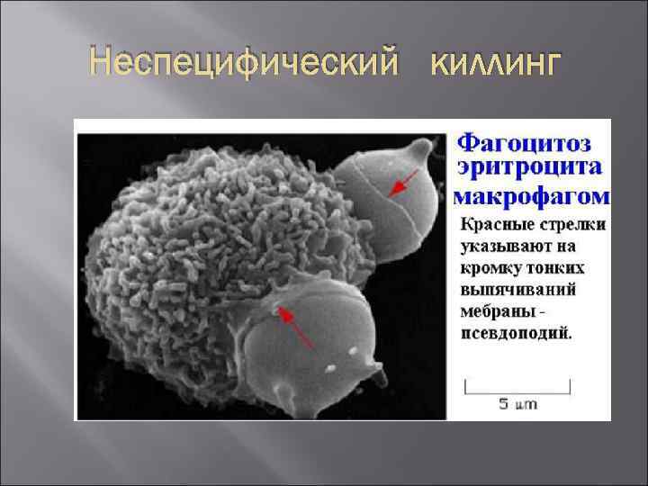 Неспецифический киллинг 