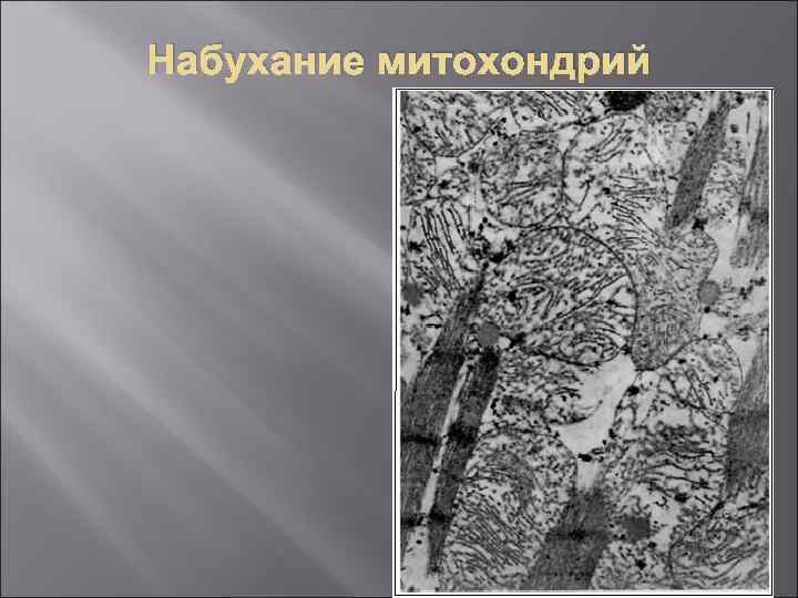 Набухание митохондрий 