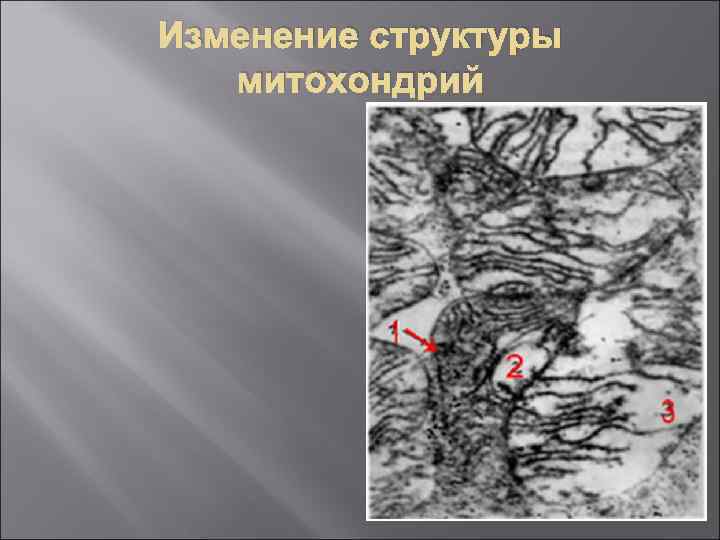 Изменение структуры митохондрий 