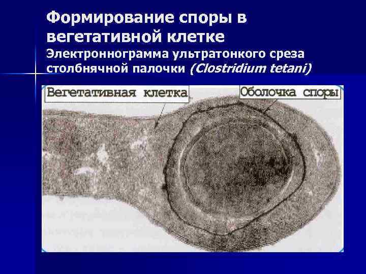 Формирование споры. Распространение в природе столбнячной палочки.. Столбнячная палочка строение клетки. Споры и вегетативные клетки.