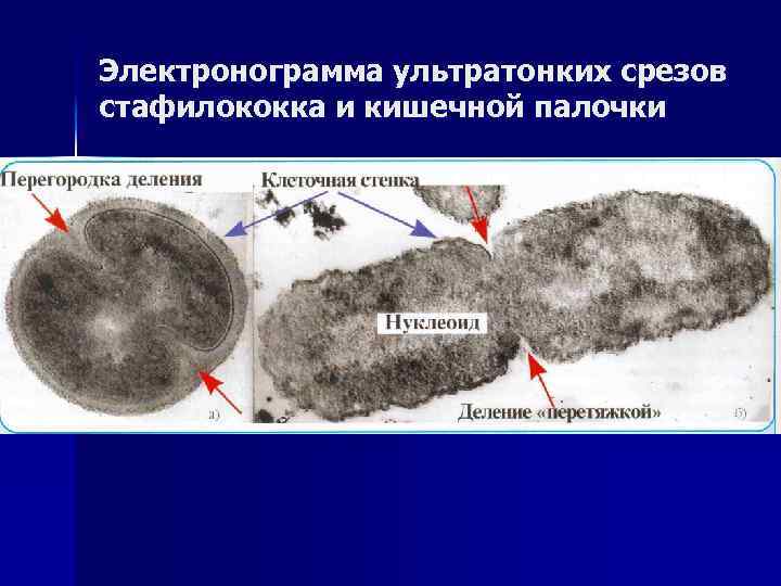Электронограмма ультратонких срезов стафилококка и кишечной палочки 