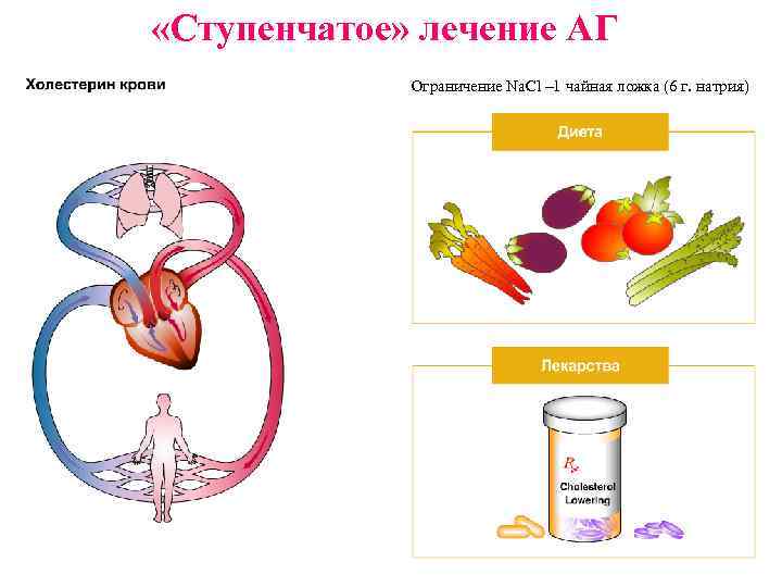  «Ступенчатое» лечение АГ Ограничение Na. Cl – 1 чайная ложка (6 г. натрия)