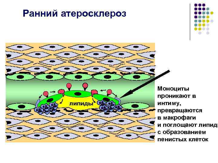 Ранний атеросклероз липиды Моноциты проникают в интиму, превращаются в макрофаги и поглощают липиды с