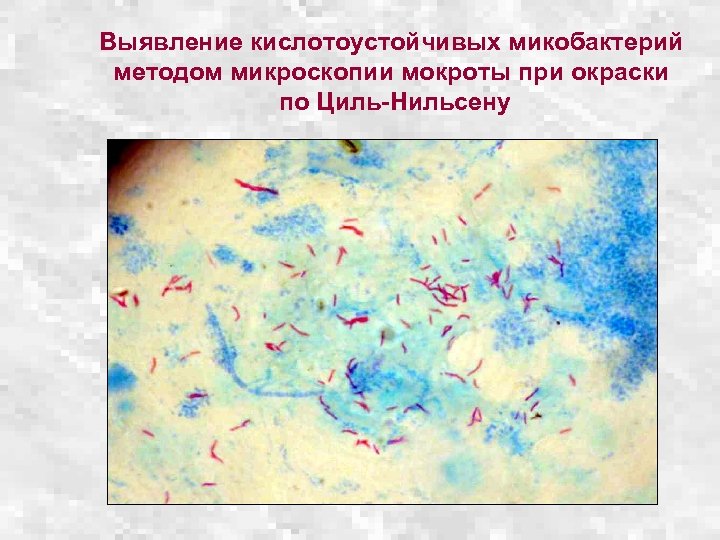 Микобактерии методы микроскопии