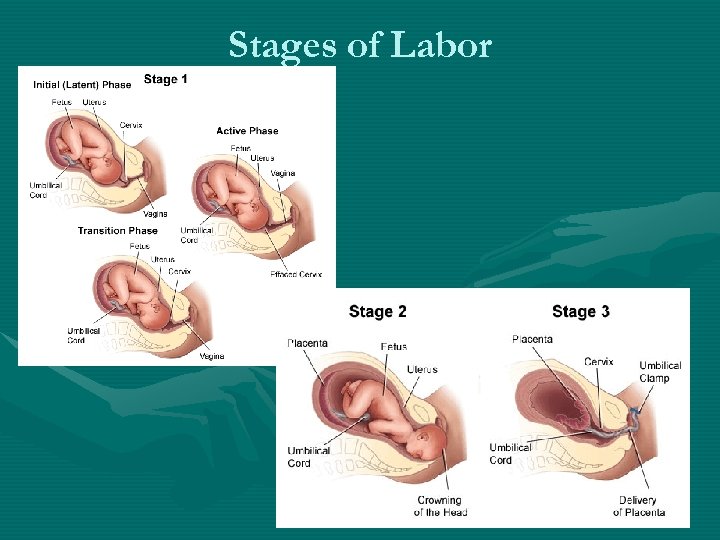 Stages of Labor 