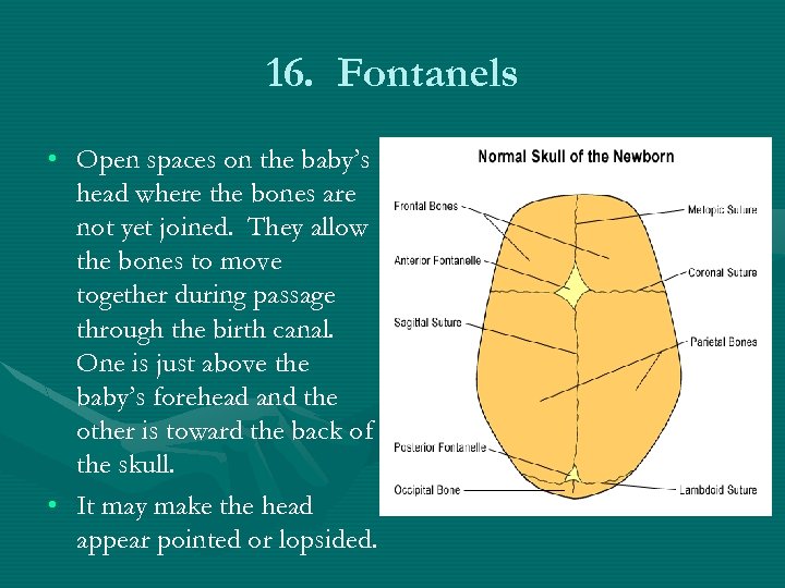 16. Fontanels • Open spaces on the baby’s head where the bones are not