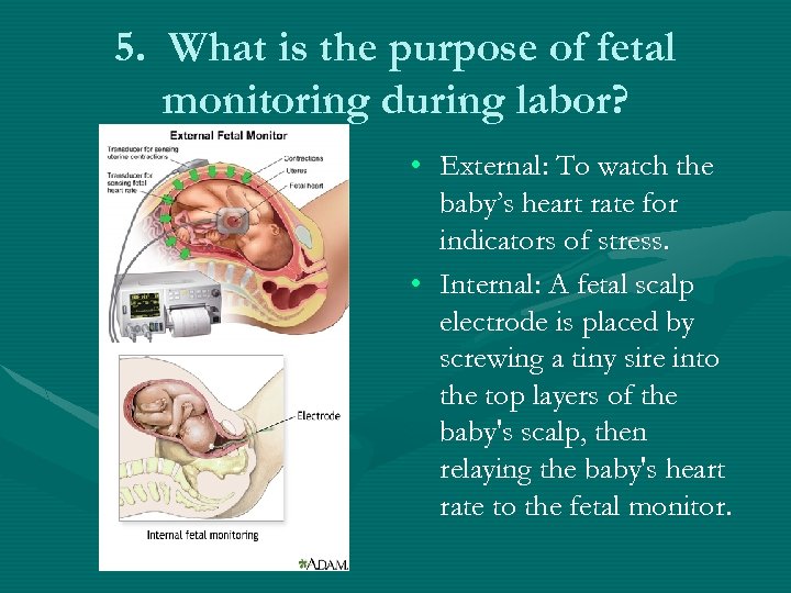 5. What is the purpose of fetal monitoring during labor? • External: To watch