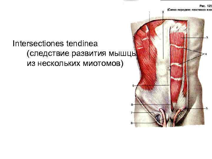 Intersectiones tendinea (следствие развития мышцы из нескольких миотомов) 