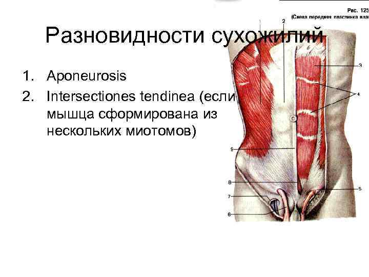 Разновидности сухожилий 1. Aponeurosis 2. Intersectiones tendinea (если мышца сформирована из нескольких миотомов) 
