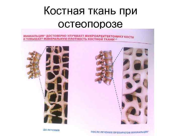 Костная ткань лабораторная работа