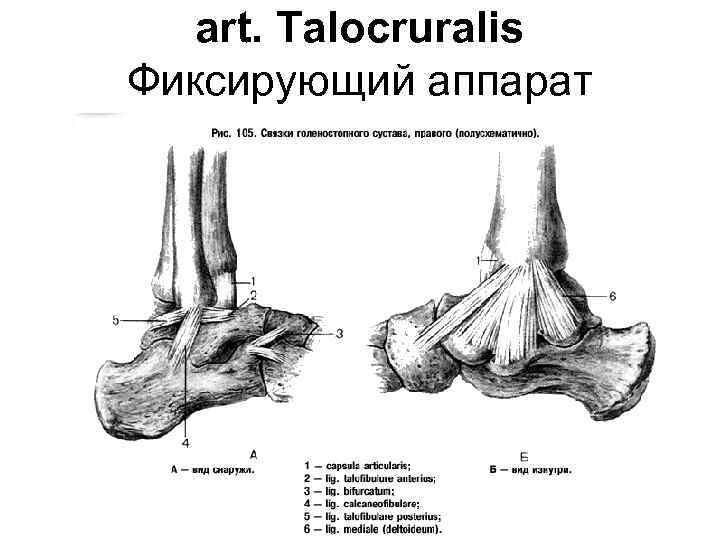 art. Talocruralis Фиксирующий аппарат 