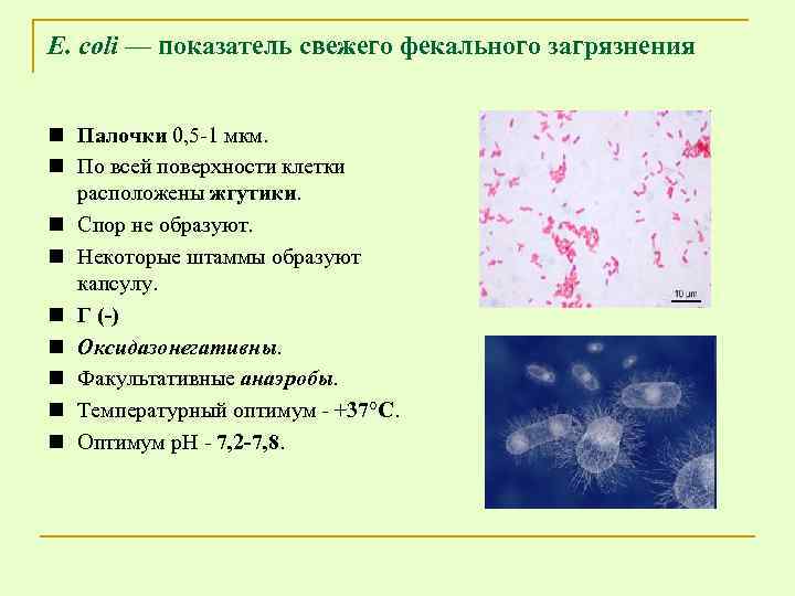 Е. coli — показатель свежего фекального загрязнения n Палочки 0, 5 -1 мкм. n