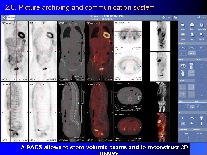 2. 6. Picture archiving and communication system A PACS allows to store volumic exams