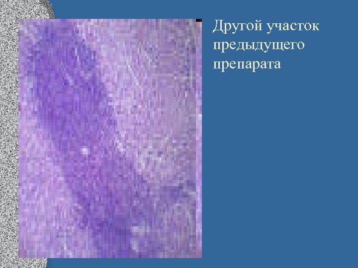  • Другой участок предыдущего препарата 