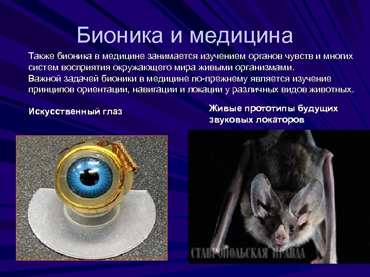 Бионика и медицина Также бионика в медицине занимается изучением органов чувств и многих систем