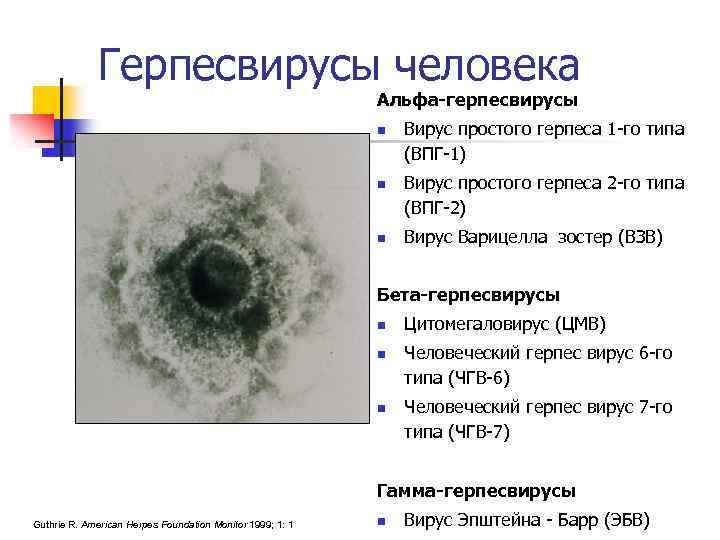 Вирусы 1 группы. Вирусы группы герпеса характеристика. К герпесвирусам относятся вирусы. Вирусы герпеса Альфа Гама.