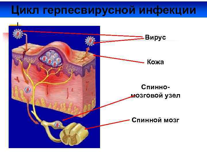 Цикл герпесвирусной инфекции Вирус Кожа Спинномозговой узел Спинной мозг 
