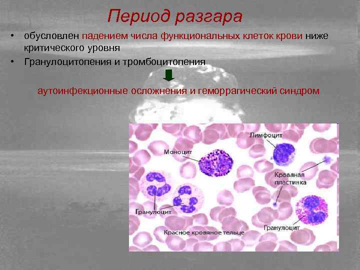 Картина панцитопении и агранулоцитоза характерна для следующего периода олб