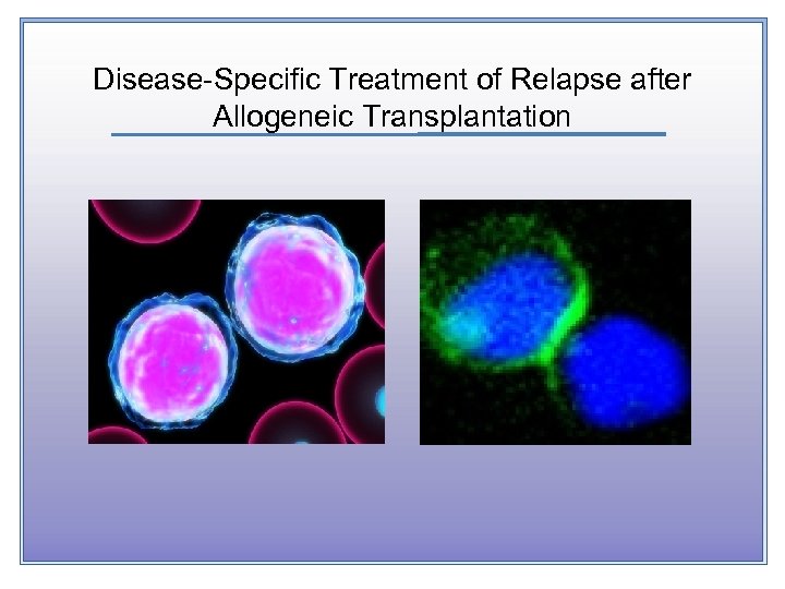 Disease-Specific Treatment of Relapse after Allogeneic Transplantation 