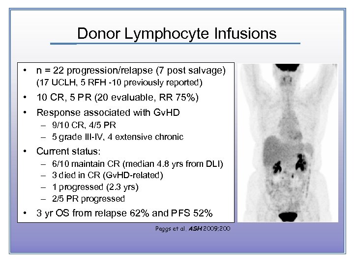 Donor Lymphocyte Infusions • n = 22 progression/relapse (7 post salvage) (17 UCLH, 5