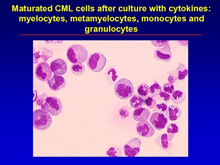Maturated CML cells after culture with cytokines: myelocytes, metamyelocytes, monocytes and granulocytes 