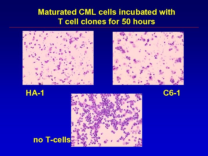Maturated CML cells incubated with T cell clones for 50 hours HA-1 no T-cells