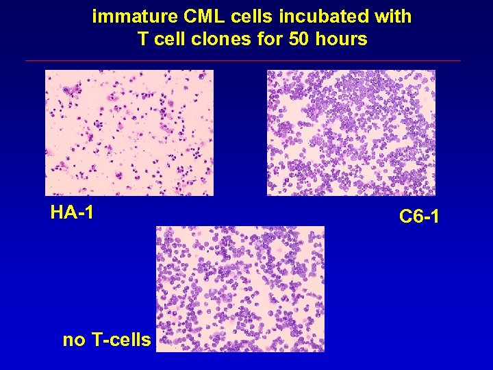 immature CML cells incubated with T cell clones for 50 hours HA-1 no T-cells