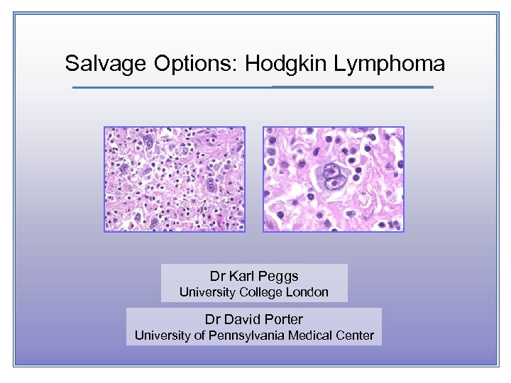 Salvage Options: Hodgkin Lymphoma Dr Karl Peggs University College London Dr David Porter University