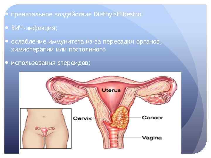  пренатальное воздействие Diethylstilbestrol ВИЧ-инфекция; ослабление иммунитета из-за пересадки органов, химиотерапии или постоянного использования