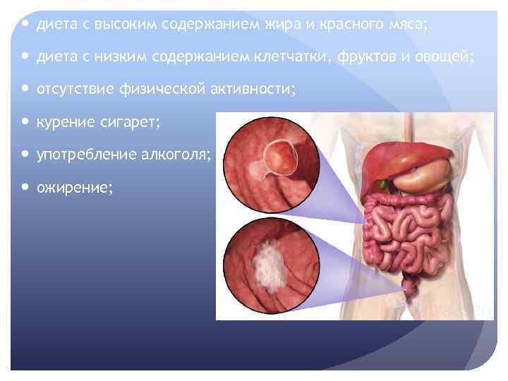  диета с высоким содержанием жира и красного мяса; диета с низким содержанием клетчатки,