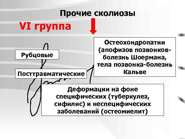 Прочие сколиозы VI группа Рубцовые Посттравматические Остеохондропатии (апофизов позвонковболезнь Шоермана, тела позвонка-болезнь Кальве Деформации