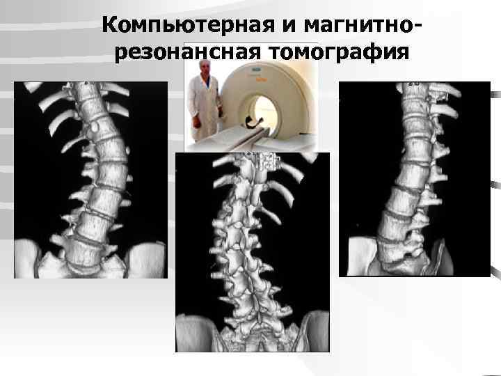 Компьютерная и магнитнорезонансная томография 