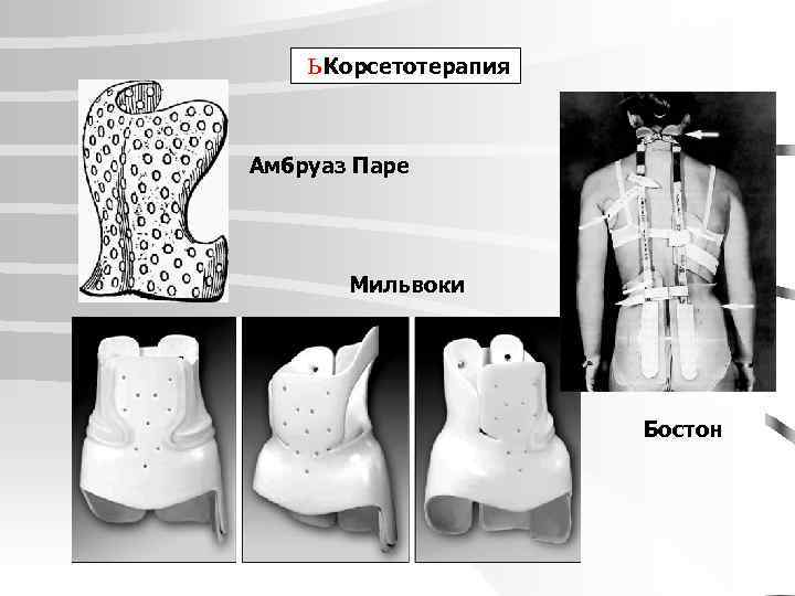 ь Корсетотерапия Амбруаз Паре Мильвоки Бостон 