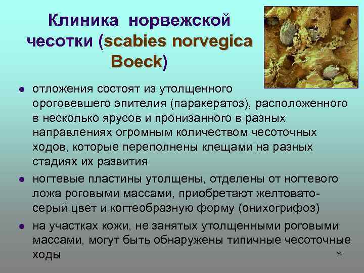 Клиника норвежской чесотки (scabies norvegica Boeck) Boeck l l l отложения состоят из утолщенного