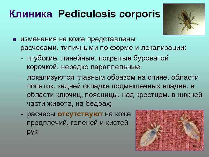 Клиника Pediculosis corporis изменения на коже представлены расчесами, типичными по форме и локализации: -