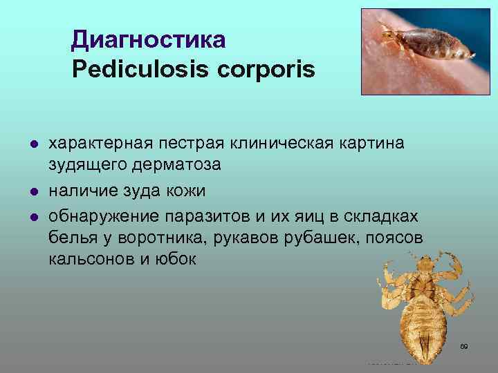 Диагностика Pediculosis corporis l l l характерная пестрая клиническая картина зудящего дерматоза наличие зуда