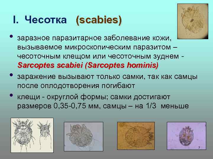 I. Чесотка (scabies) • • • заразное паразитарное заболевание кожи, вызываемое микроскопическим паразитом –