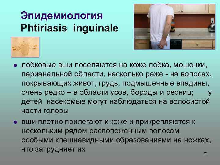 Эпидемиология Phtiriasis inguinale l l лобковые вши поселяются на коже лобка, мошонки, перианальной области,